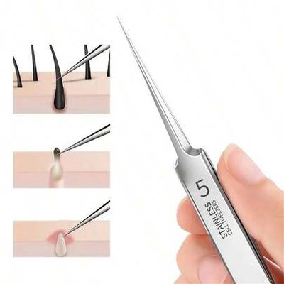 Makeup Ready-Made Stainless Steel Ultra-Sharp Cell Clip, Acne Clip, Blackhead Cl